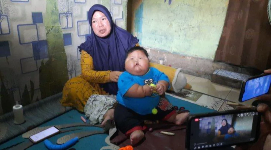 Gambar Artikel Viral Bayi Obesitas Diberi Susu Kental Manis, Ahli Gizi UM Surabaya Sebut 5 Dampaknya